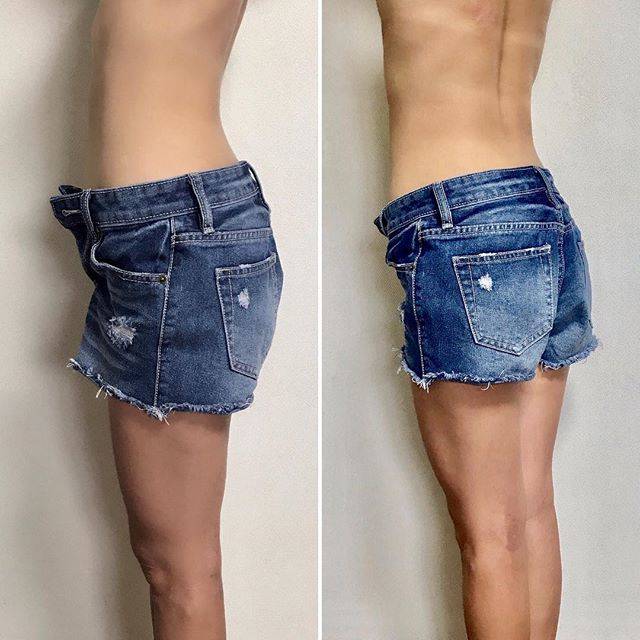 腰