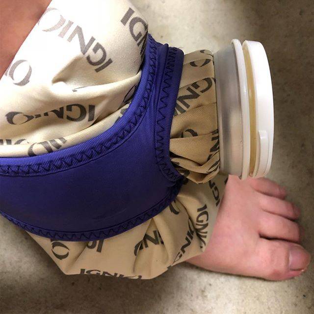 Yoshinobu MatsumotoさんはInstagramを利用しています:「今、尿酸値を下げる薬を飲んでるんやけど、その副作用でまた痛くなる事があるよ‼️ って言われたんやけど  かなり来てます?  痛みあるわ 腫れるわ 関節がうまく動かへんわ  もうホンマに嫌になる。  飯食ってなくて、疼くので  とりあえずアイシングで  誤魔化す‼️ 最悪です?…」 (59239)