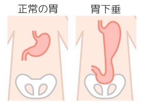 キハラケンタロウ・桃壽（トウジュ）〜長崎 on Instagram: “下腹部のポッコリお腹の原因でもある胃下垂 特に女性の悩みの一つです。  経絡（ケイラク）刺激の施術でも下垂した臓器を引き上げる作用の経絡を刺激する事で 改善することも少なくありません。  自分で出来る胃下垂への 対処法は至ってカンタン。  立った姿勢で腕をビン！と…” (126249)
